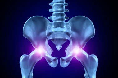 Medical illustration of the pelvis and lower spine with highlighted hip joint areas against a dark background.