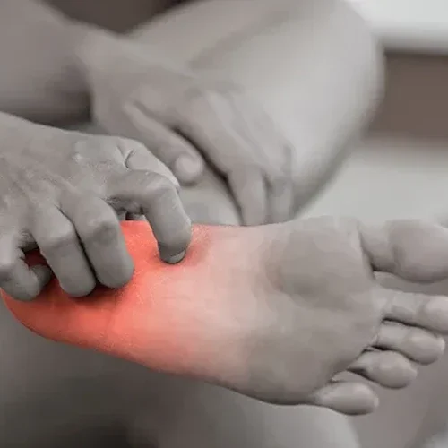 Close-up of a foot with a red-highlighted area on the sole while fingers apply pressure to the affected spot.